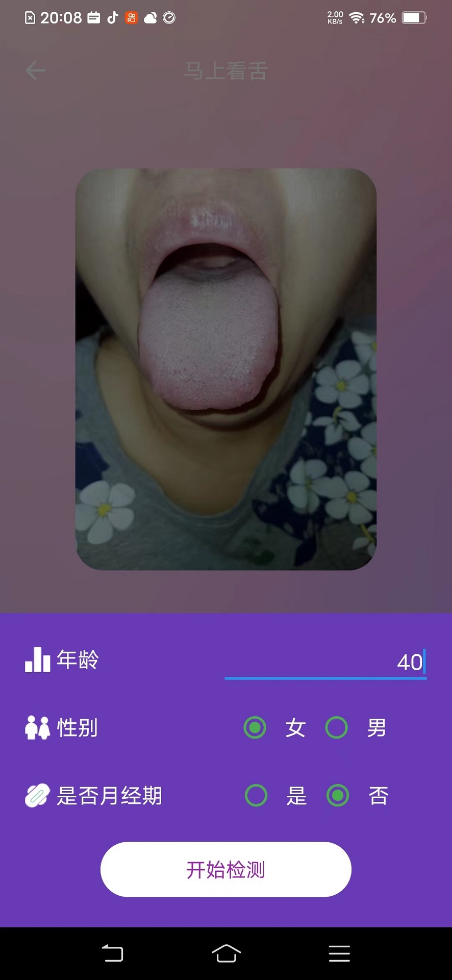 AI看舌0