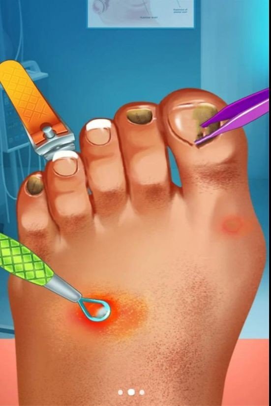 疯狂修脚模拟器1