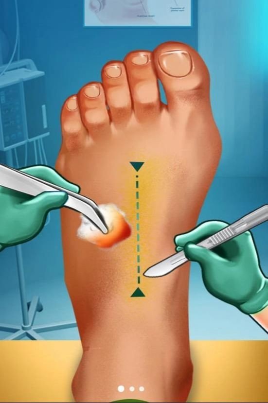 疯狂修脚模拟器2