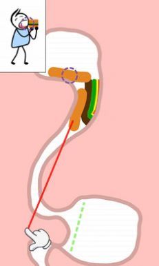 帮助我棘手的故事3