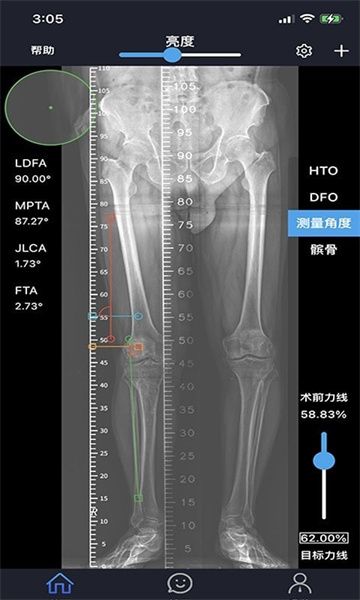 华保膝望1