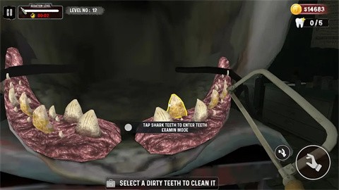 鲨鱼牙医模拟器免广告版1