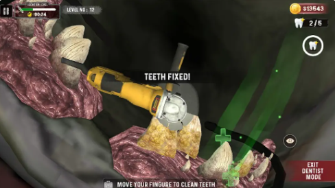 鲨鱼牙医模拟器游戏1