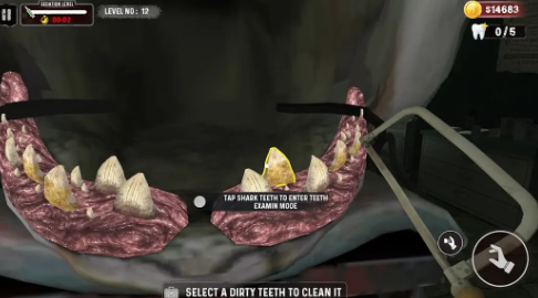 鲨鱼牙医模拟器游戏2