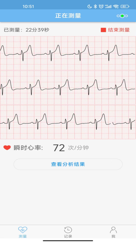 数维康心电app3