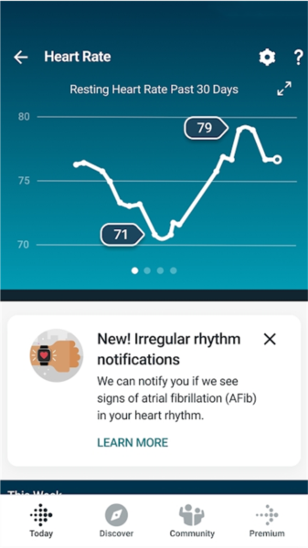 Fitbit手环4
