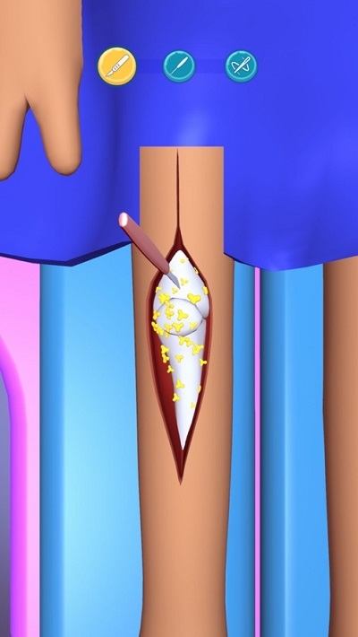 外科手术大师3D2