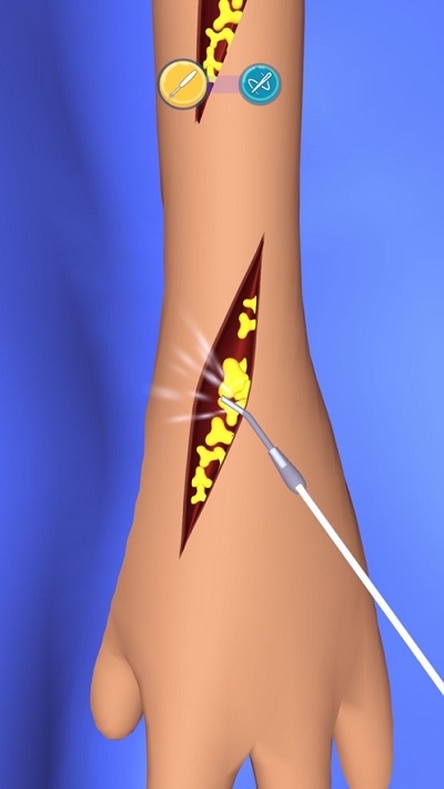 外科手术大师3D4