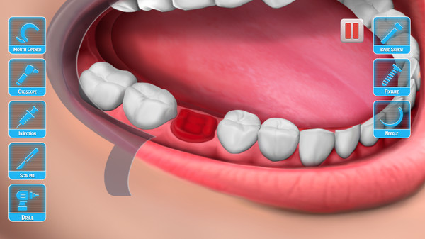 医生修个牙 医生修个牙