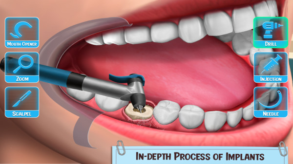 医生修个牙 医生修个牙