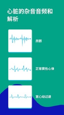 心电图ECG2